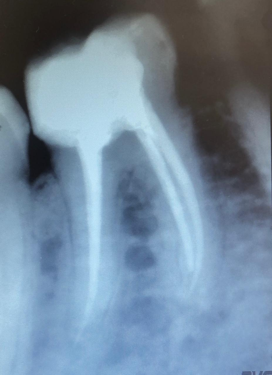 Endodontics